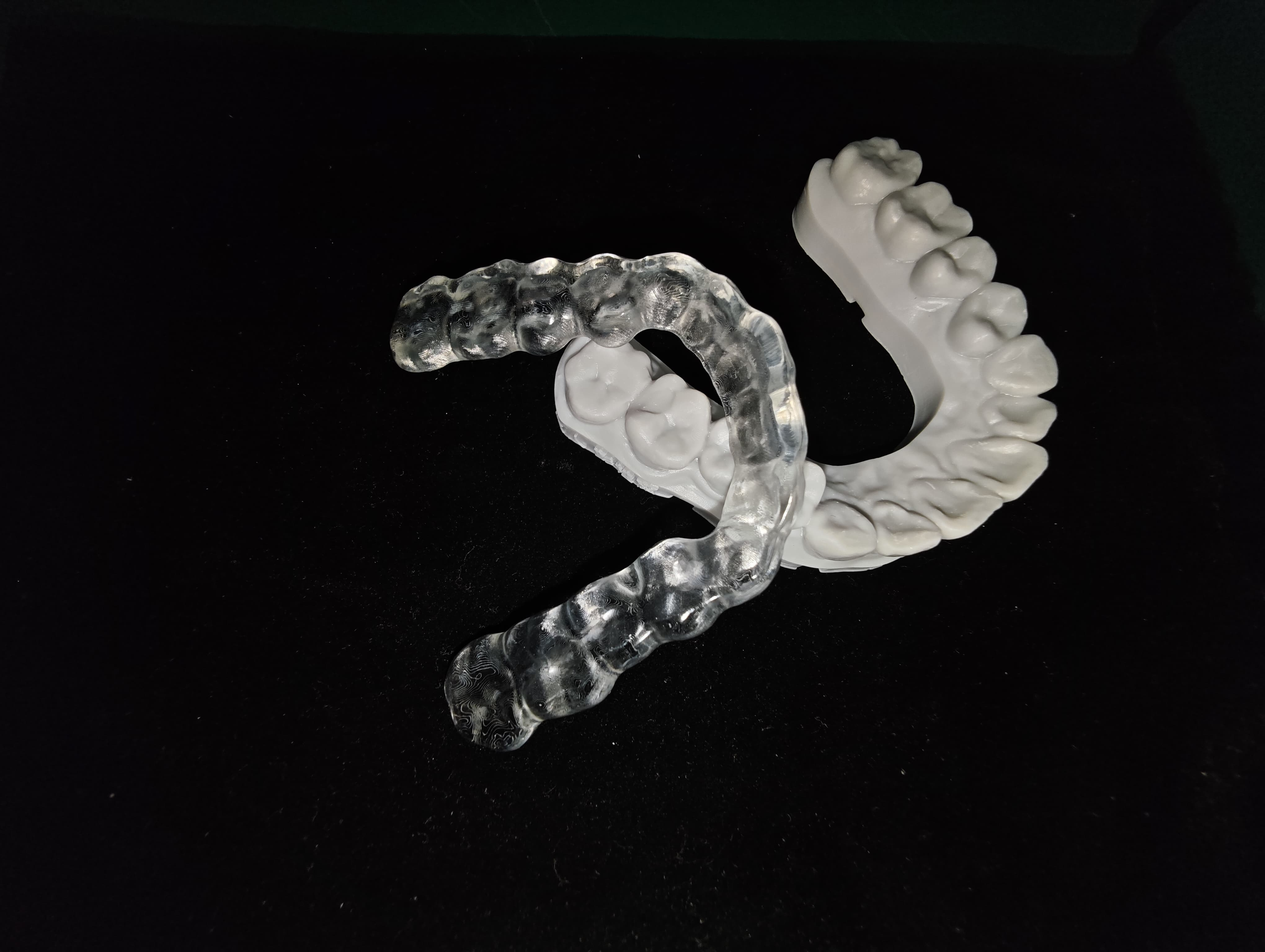splint 2